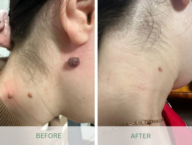 Tatiana before-after