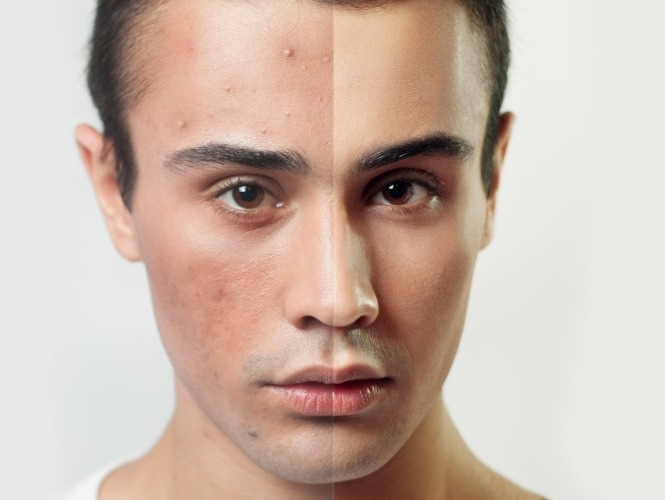 iStock-508754344 - BEFORE_AFTER PAGE HOME